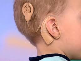 В Севастополе детям-инвалидам компенсируют затраты на слуховые импланты