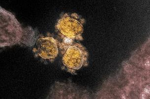 Швейцарские ученые в поисках вакцины против коронавируса